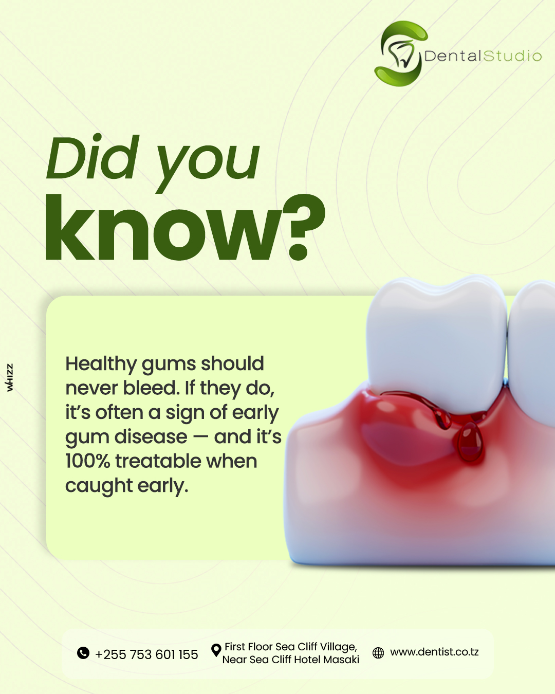 Bleeding gums are not normal.